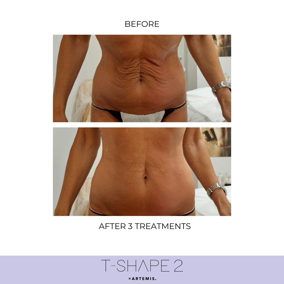 Abdomen result
