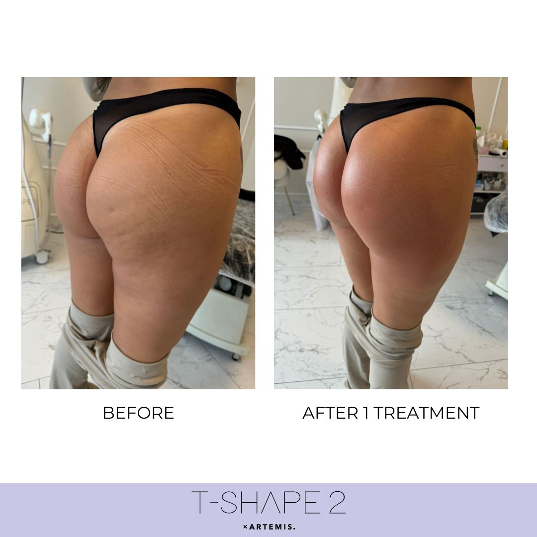 Body result