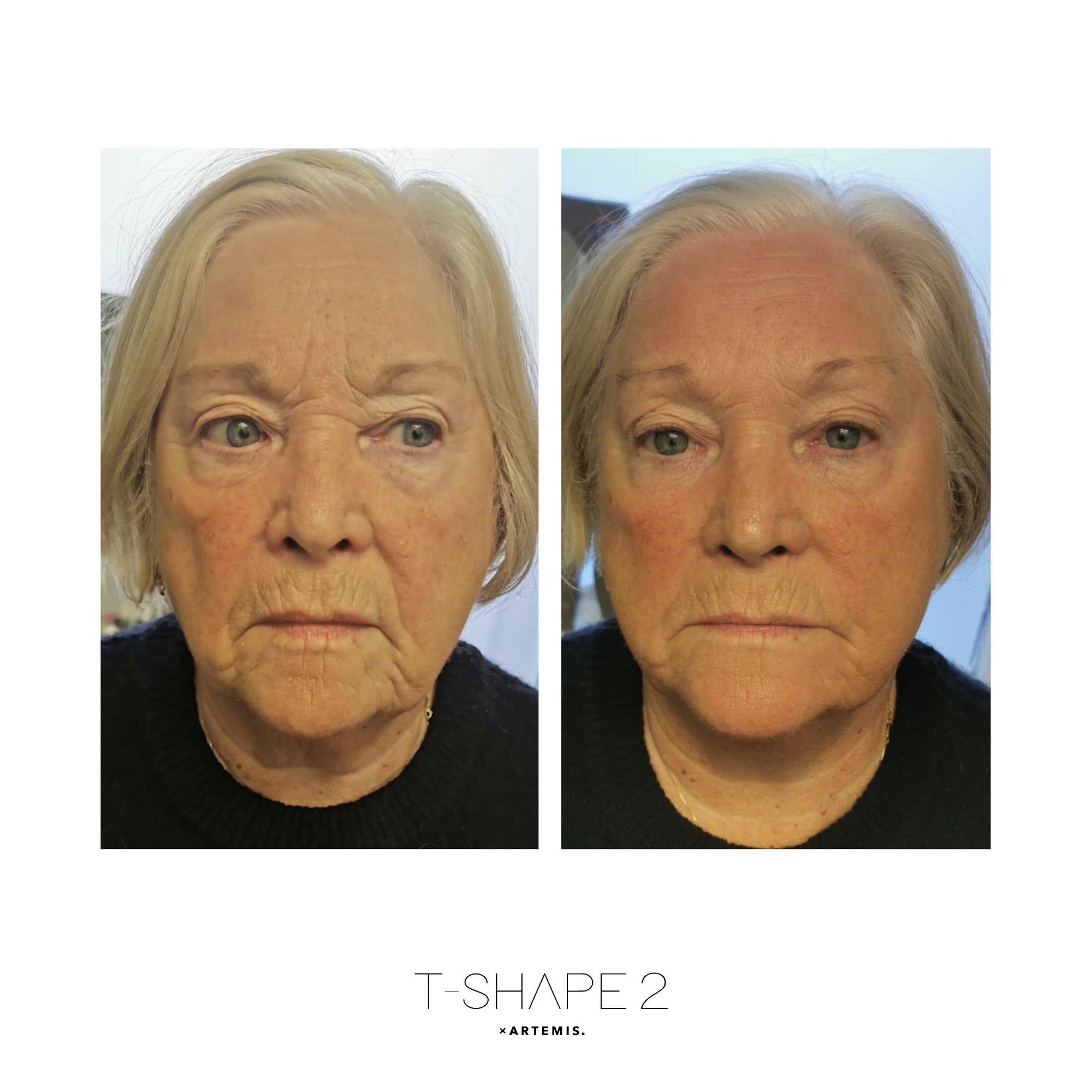 Face result
