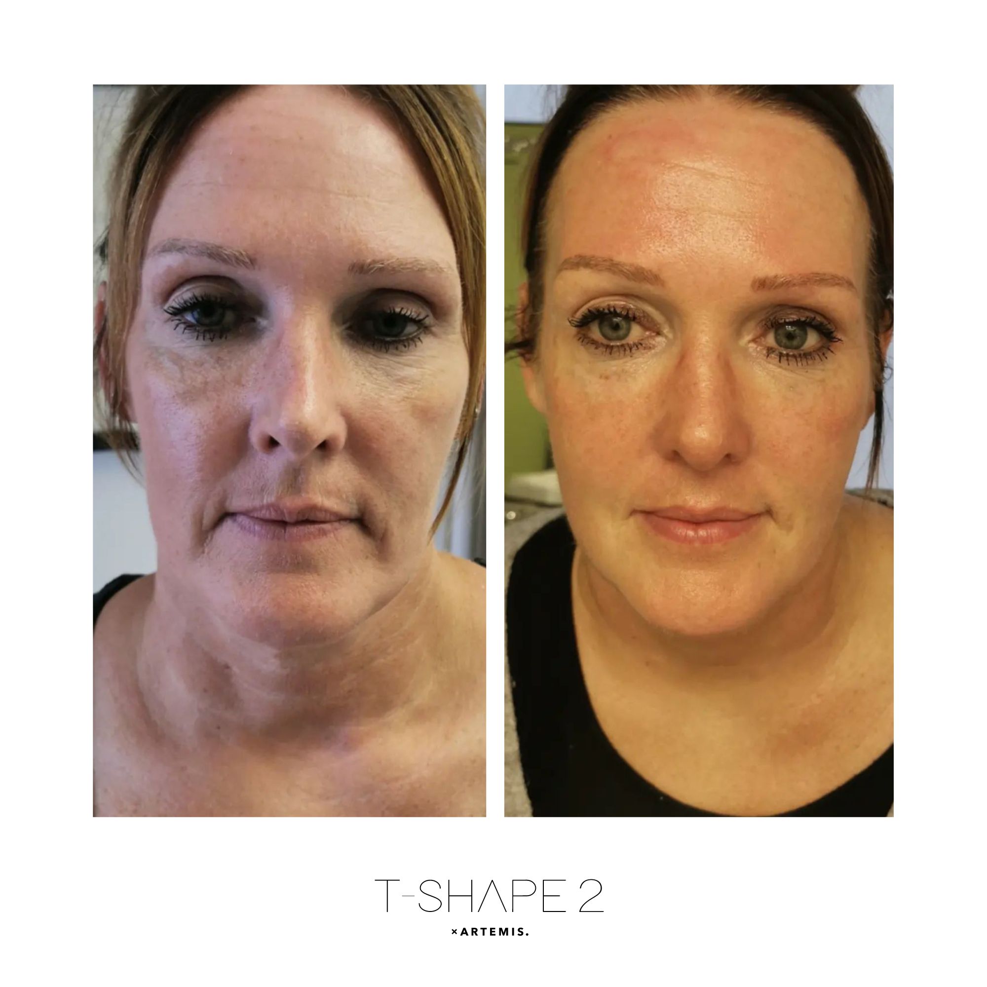 Face result